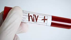 Di Kabupaten Cianjur Penularan HIV/AIDS Juga Terjadi Karena ‘Genetis’