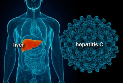 Hepatitis C yang Tidak Diperjelaskan oleh Doktermu