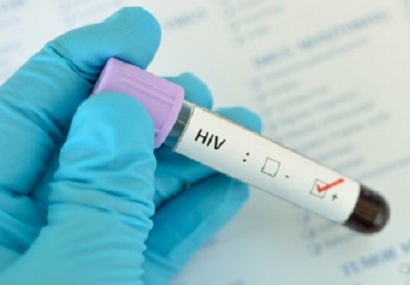 Berganti-ganti Pasangan Seks, Apakah Otomatis Tertular HIV?