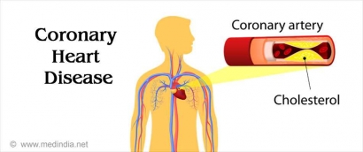Cara Melakukan Pertolongan Awal Pada Penyakit Jantung Koroner dan Kadar Kolesterol Tinggi