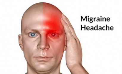 Beberapa Cara Penanganan Migrain (Nyeri Sebelah Kepala)