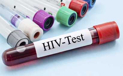 Hasil Tes HIV Suami Positif, tapi Istri Belum Beritahu Suami