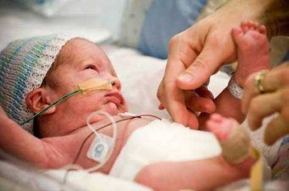 Terapi Bagi Bayi Prematur Harus Segera, Tak Boleh Ditunda