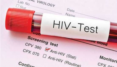 Deteksi Dini HIV/AIDS di Kota Banjarmasin Merupakan Penanggulangan di Hilir
