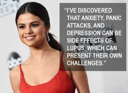 Selena Gomez Depresi karena Lupus