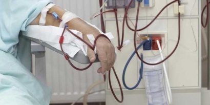 Pertimbangan Pasien untuk Memulai Cuci Darah
