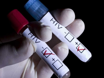 Kasihan Istri Harus Merasakan Infeksi HIV Akibat Ulah Suami