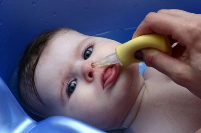 Cara Mengatasi Hidung Tersumbat pada Bayi