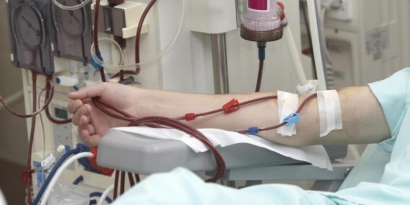 Mesin Cuci Darah untuk Pasien dengan Penyakit Hepatitis dan HIV Harus Dipisah