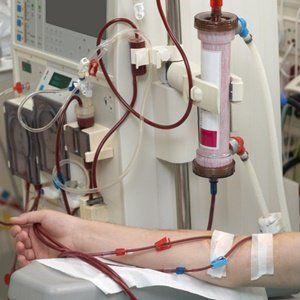 Mengenal Hemodialisis atau Cuci Darah