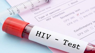 Tes HIV Dilakukan oleh Teman dengan Alat Tes yang Dibeli Sendiri