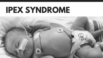 Kenali Penyakit Langka di Dunia, IPEX Syndrome