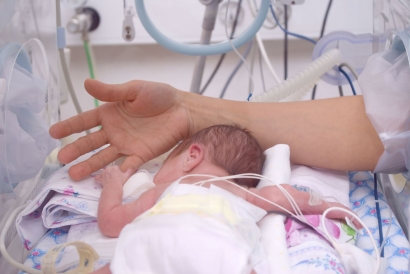 Bayi Lahir Prematur dengan Perawatan Murah dan Mudah 75 Persen Bertahan Hidup