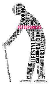 Kurangi Risiko Osteoporosis dengan 7 Hal Ini