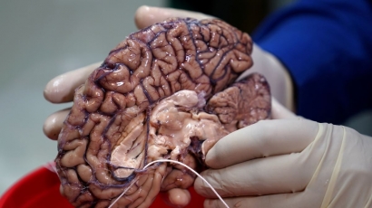 Otak Buaya! Sindrom yang Bikin Kita Tidak Pernah Berhenti "Nge-Hoaks"