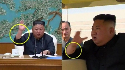 Misteri Titik Hitam di Lengan Kim Jong Un