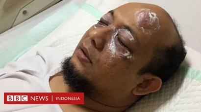 "LAWAK LO BADUT" Pelaku Penyiraman Novel Baswedan Dituntut 1 Tahun Penjara