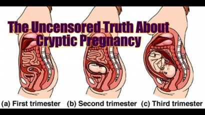 Cryptic Pregnancy, Angin dan Air Penyebab Hamil?