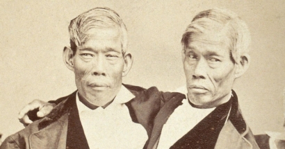 Kisah Hidup Kembar Chang dan Eng, Pencetus Istilah Kembar Siam