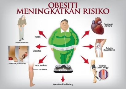 Obesitas, Bikin Aktivitas Jadi Kurang