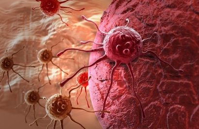 Penerapan Biologi dan Fisika dalam Pengobatan Penyakit Kanker 