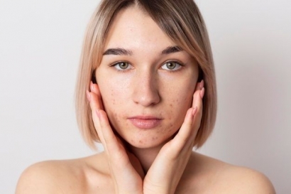 Khusus Kulit Sensitif, Pastikan Bahan Ini Ada di Skincare Kamu