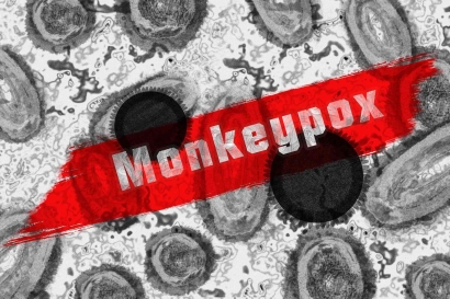 Wabah Cacar Monyet (Monkeypox), Tak akan Jadi Pandemi?