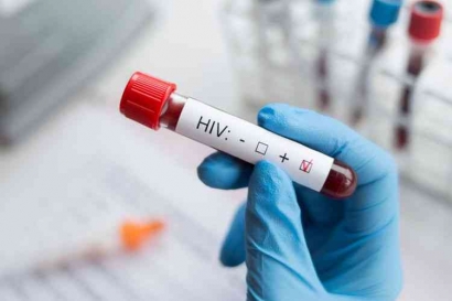 Banyak Ditemukan Kasus HIV di Jawa Barat, Kenali Gejala HIV dan Cara Penularan HIV