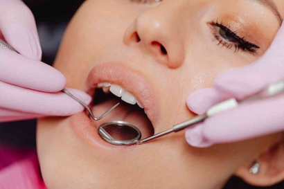 Memanfaatkan Fasilitas Scalling Gigi dengan BPJS Kesehatan