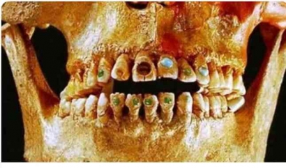 Mengintip Kecantikan Wanita Kuno dari Gigi Tengkorak Bertahta Batu Mulia