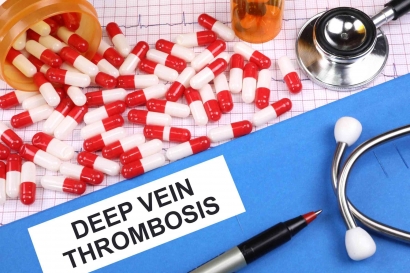 Pentingnya Personalized Medicine pada Penentuan Dosis Warfarin yang Tepat dan Efektif dalam Pengobatan Thrombosis