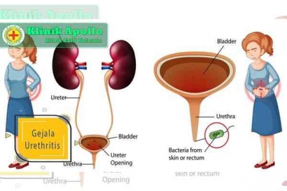 Kenali Tanda dan Gejala Penyakit Urethritis