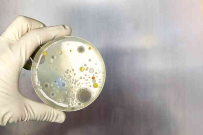 Pusat Koleksi Kultur: Bagaimana Mikroba Disimpan?