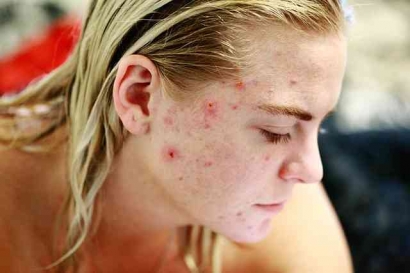 Tips Penggunaan Skincare Untuk Permasalahan Kulit