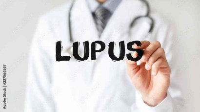 Memahami Lebih Jauh Mengenai Penyakit Autoimun Lupus (SLE)