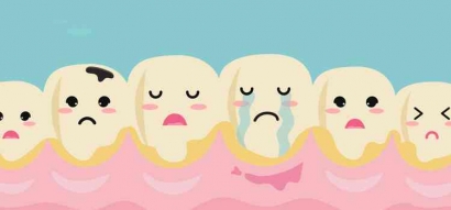 Karang Gigi Masih Jadi Salah Satu Masalah Mulut yang Mengganggu