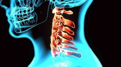 "Spinal Cord Injury Cervical (Area Leher)"