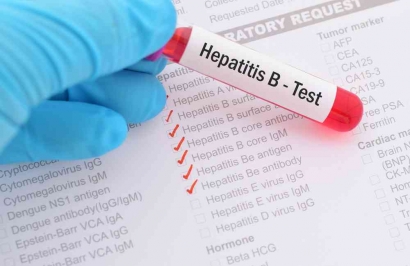 Berita tentang Hepatitis B Misleading Dorong Stigmatisasi Terhadap Perempuan