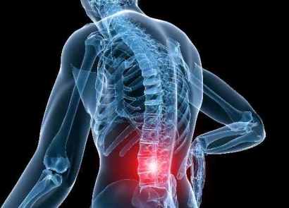 Mengenal Lower Back Pain