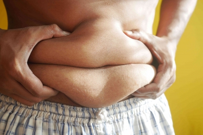 Ancaman Obesitas pada Anak dan Cara Mengatasinya