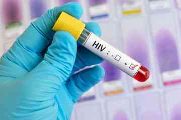 Kenali Jenis Pemeriksaan untuk Deteksi Virus HIV