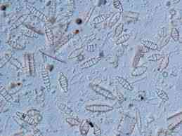 Keindahan Mikro Dunia: Eksplorasi Menakjubkan Bacillariophyta dalam Ekosistem Air