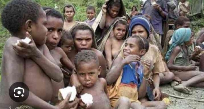 Malnutrisi dan Kemiskinan Penyebab Stunting Merajalela 