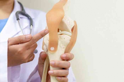 Bahaya Dampak Osteoporosis dan Pencegahannya